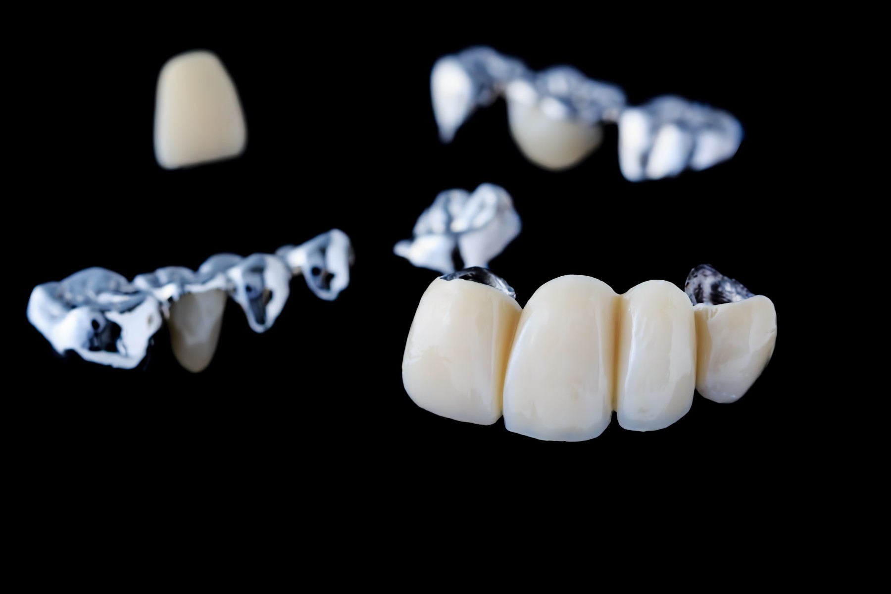 what goes into the cost of dental bridges